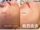 クオーレ 福津(cuore)の写真