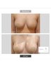 ◆バストアップ◆ [いたみ無しで脂肪細胞を増やす！！]脂肪増殖5ml