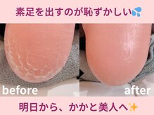 スロース鍼灸整体院(SLOTH鍼灸整体院)/素足を出すのが恥ずかしく