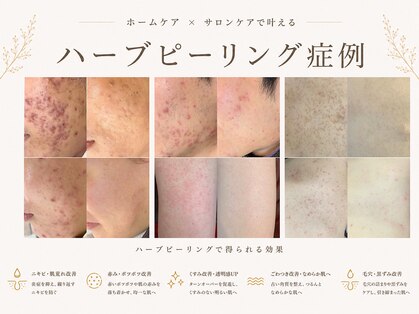 イチロクイチハチ(1618)の写真
