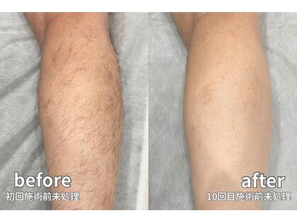 シェアサロン レノール(SHARE SALON LENORL)の写真