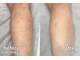 シェアサロン レノール(SHARE SALON LENORL)の写真