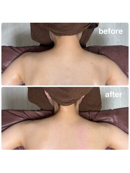 ベルパス(bellepas)の写真/貸切個室のプライベート空間で、ぐっすり眠ってみませんか？肩こり首こり/ヘッド/リンパ/フェイシャル