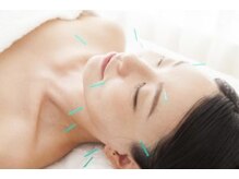 船橋はりきゅう整骨院/【ターンオーバー改善】美容鍼★