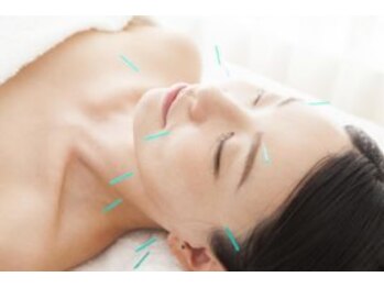 船橋はりきゅう整骨院/【ターンオーバー改善】美容鍼★