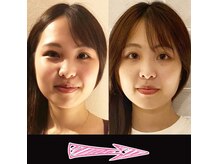 ネルジム 札幌店(NERU GYM)/2回目の施術の成果！