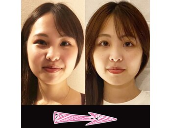 ネルジム 札幌店(NERU GYM)/2回目の施術の成果！