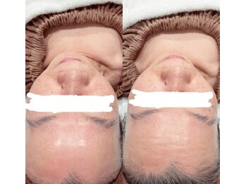 ギャラクシービューティー(galaxy beauty)/20分で変わるシワケア☆