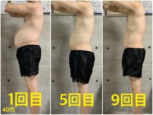 ペリー(PELLY)/男性40代　before after