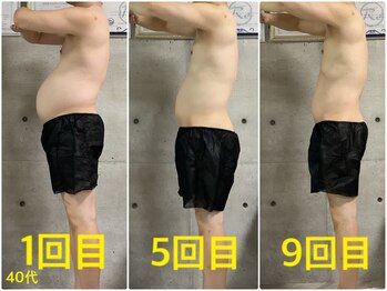 ペリー(PELLY)/男性40代 before after