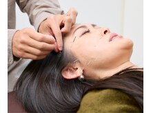 ハリカフェ(HARI CAFE)の雰囲気（"電気美容鍼で血行を促進し【むくみ】を流していく）