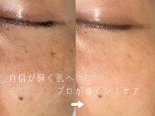 サロンドシエル カスガイ(Salon de Ciel kasugai)/自信輝く肌、プロが導くシミケア