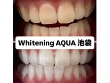 アクア 池袋店(AQUA)/ホワイトニング/池袋/東京/美白