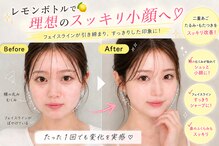ブールドネージュ(Boule de Neige)