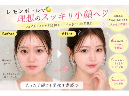 ブールドネージュ(Boule de Neige)の写真
