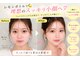 ブールドネージュ(Boule de Neige)の写真