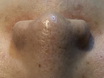 ベルーチェ(Beluce)/酵素の力で毛穴汚れ分解