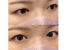 リーベル(Liebelle)/ラッシュリフト