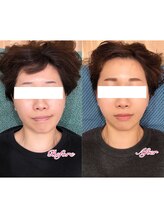 整体院 椿/人気の小顔矯正