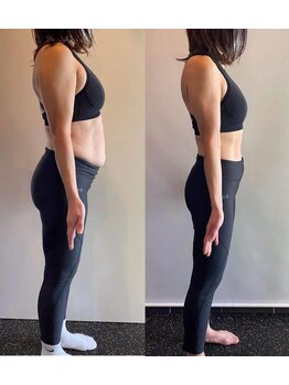 ストルツ(STOLZ)/約3ヶ月でこの変化!