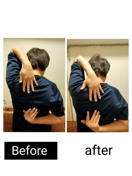 アース エンジェル整体院/ビフォアフ 肩甲骨はがし