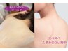 夏に向けて！背中のくすみブツブツ解決!スベスベツルツル背中美人!¥12100→