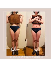 バンブー B2 新涯店(Bamboo)/メラメラダイエットコース