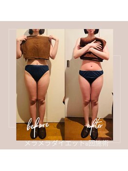 バンブー B2 新涯店(Bamboo)/メラメラダイエットコース