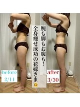 アモ(amo.)/都度払い♪ブライダルエステ