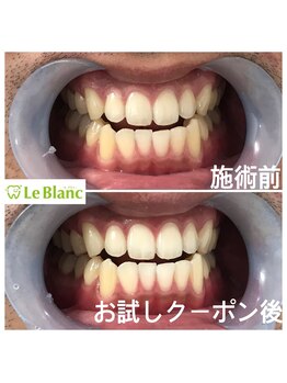 ルブラン 奈良店(Le Blanc)/男性の方も通いやすいサロン