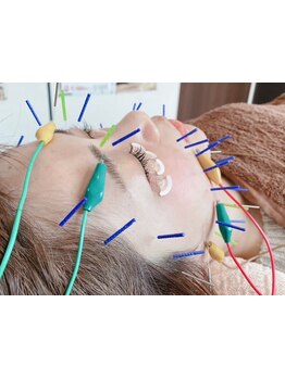 小顔になりたい