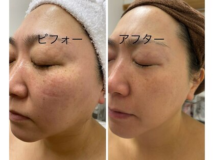 シェリラソワン(Che'rie La Soin)の写真