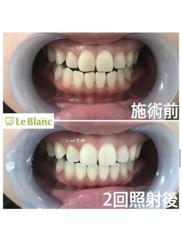 ルブラン 奈良店(Le Blanc)/第一印象が変わる！