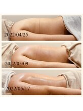 アオ(ao)/上半身コース