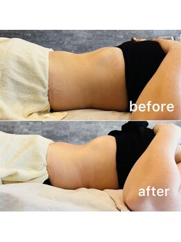 キノ(Kino)/脂肪冷却★