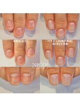 ニコプラス(NICO+)/自爪育成中