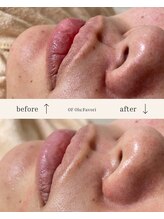 オフオルファヴォリ(OF Olu:Favori)/【フラッシュワックス脱毛】