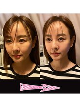 ネルジム 札幌店(NERU GYM)/1回の施術でこの効果！