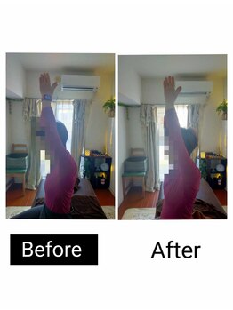 アース エンジェル整体院/ビフォアフ 肩こり ストレッチ