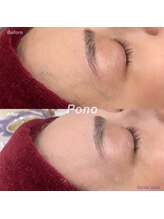 ポノ 獨協大学前店(pono)/マリムーブwax部分