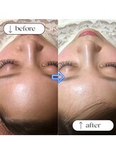 トータルビューティーサロンリア(Li'a)/ビフォー＆アフター