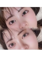 リリージョワ(Lily joie)/マツパビフォーアフター♪