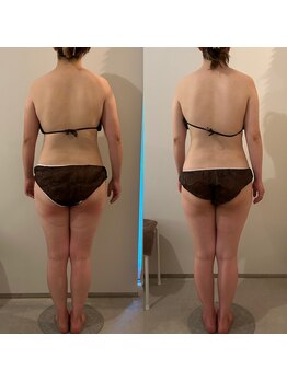 ラナ 京都西院店(Lana)/スマホ首・ストレートネックに