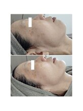 ビーユー(Be.you)/シミとたるみでお悩みの方