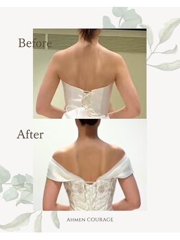 アーマンクラージュ(Ahmen Courage)/ブライダルエステ【赤羽/痩身】