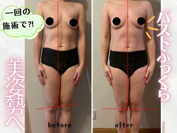 育乳整体&バストアップ専門店 Laurino salon【バストアップ/整体/姿勢改善/産後】/姿勢から整えるから戻りにくい!