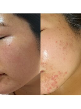 ダリア(Dahlia)/インセルダム