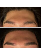 ウイユサロン(oeilsalon)/眉毛ワックス＋フェイスワックス