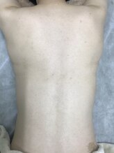 ナノハナ/鹿沼市本格全身脱毛ナノハナ