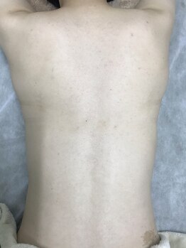 ナノハナ/鹿沼市本格全身脱毛ナノハナ